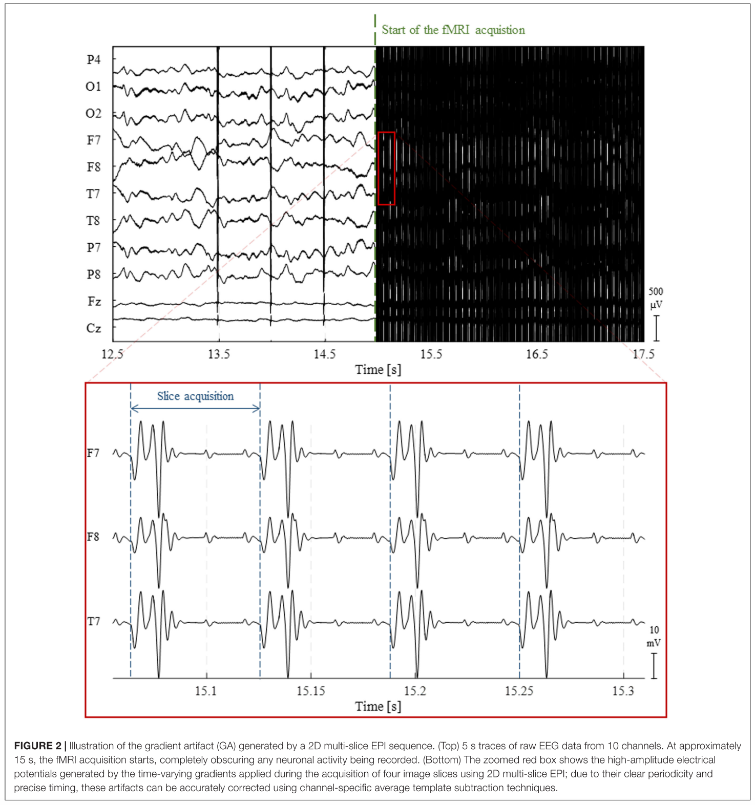 A visualization of how EEG can be bastardized with fMRI input, without artifact removal and filtering.